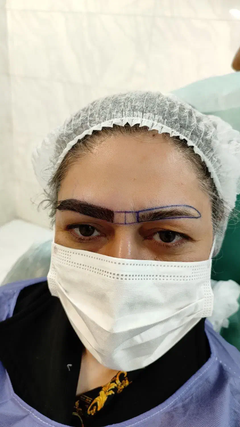 کاشت مو و ابرو در گلپایگان|خدمات آرایشگری و زیبایی|فریدونشهر, |دیوار