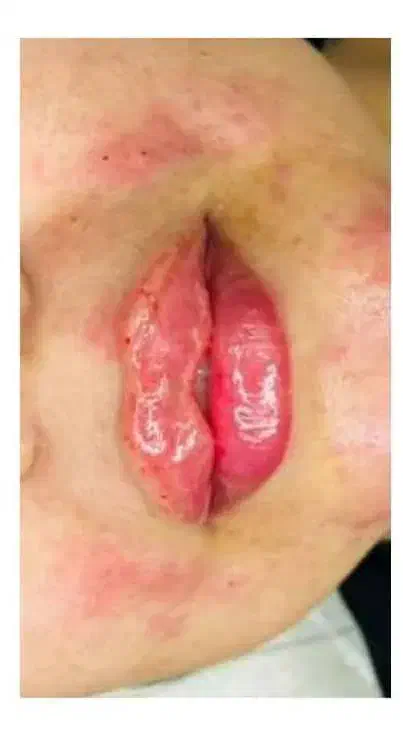 تزریق و آموزش خدمات ژل و بوتاکس و کراتین مو|خدمات آرایشگری و زیبایی|هشتگرد, شهرک اداری|دیوار