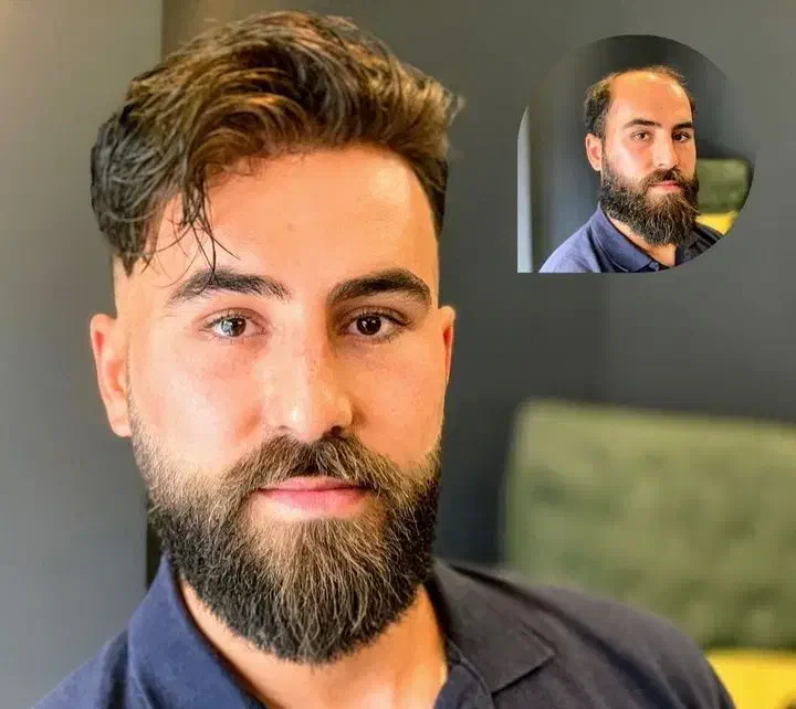 پروتز مو معجزه زیبایی|خدمات آرایشگری و زیبایی|اصفهان, ملک|دیوار