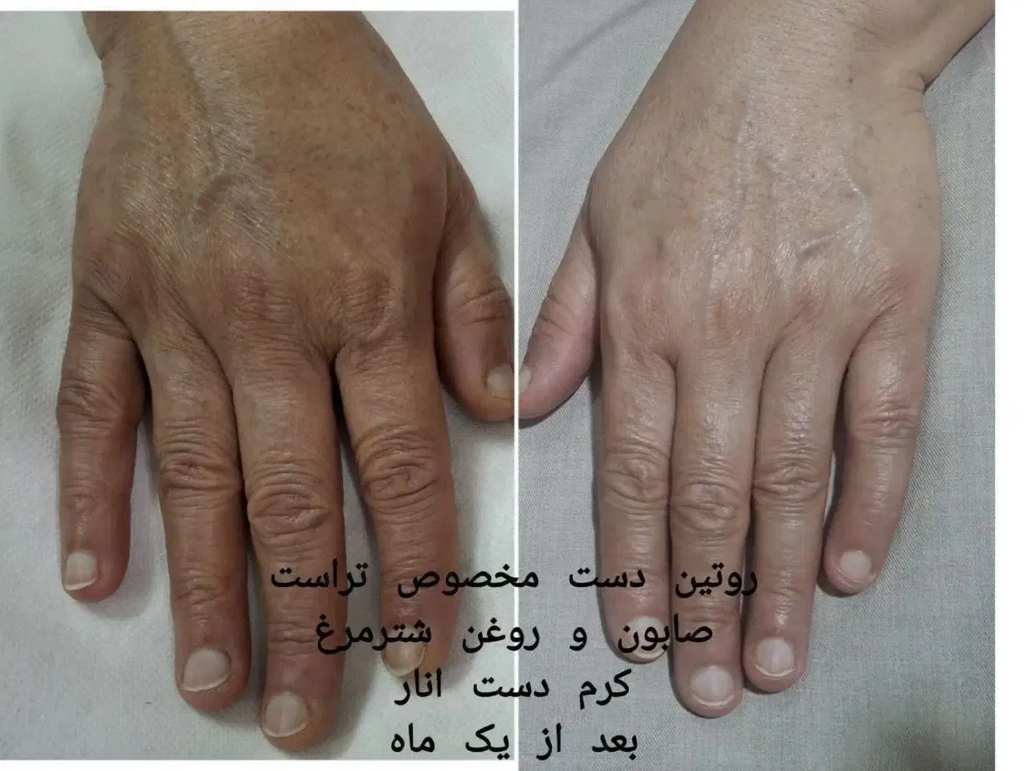 حراج محصولات پوست و مو|حراج|قم, پردیسان|دیوار