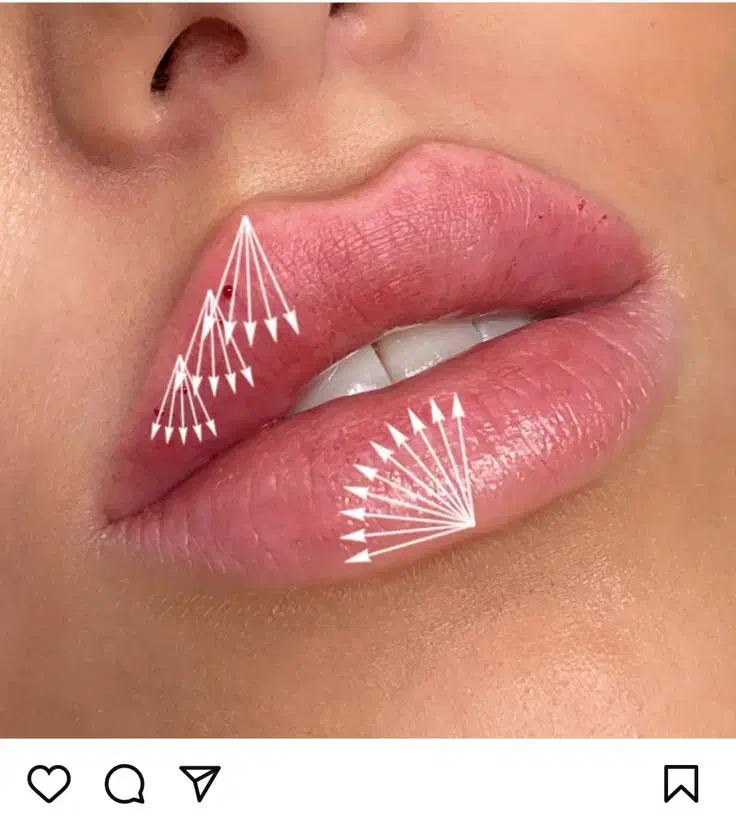 جشنواره آموزشی فیلر نخ بوتاکس زیر نظر دکتر...|خدمات آموزشی|تهران, قلهک|دیوار