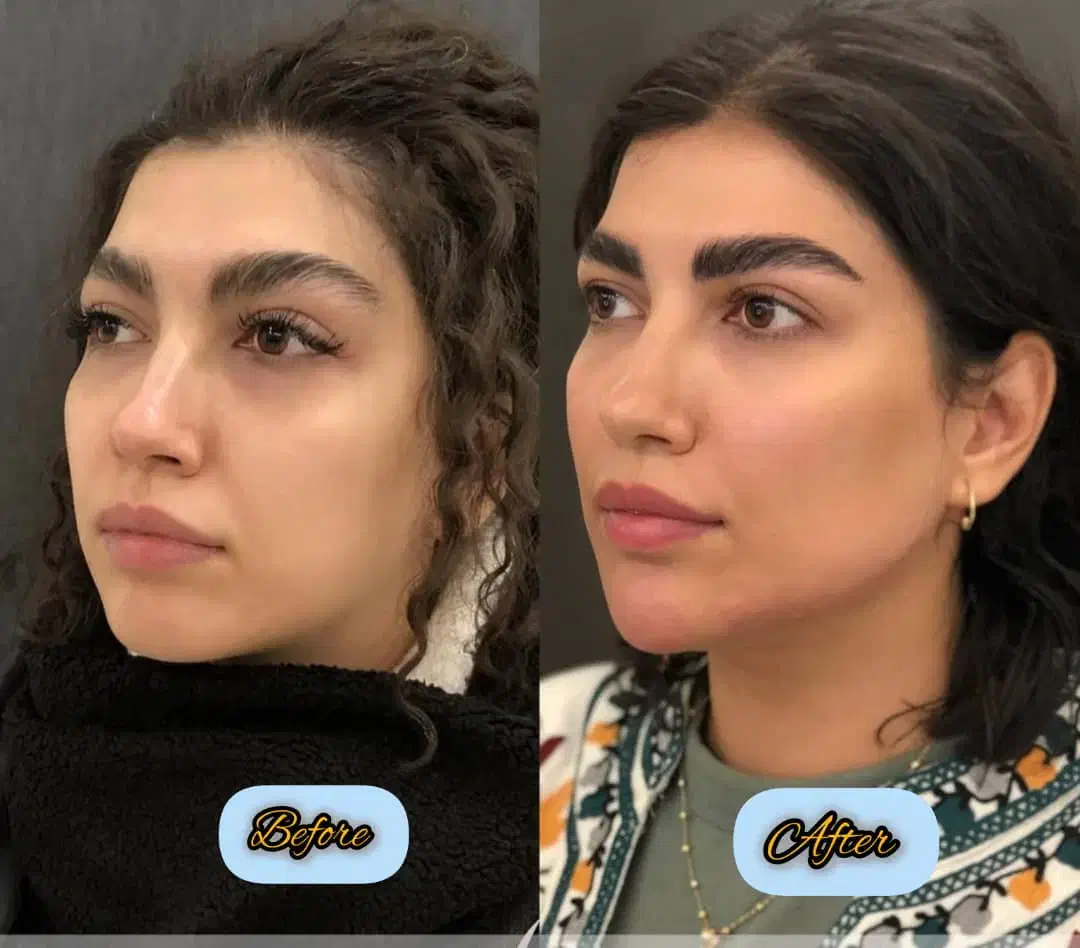 کلینیک تخصصی ژل و بوتاکس|خدمات آرایشگری و زیبایی|شاهین‌شهر, فردوسی|دیوار