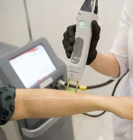 لیزر موهای زائد با دستگاه کندلا2025فول بادی فقط990|خدمات آرایشگری و زیبایی|قرچک, زیبا شهر|دیوار