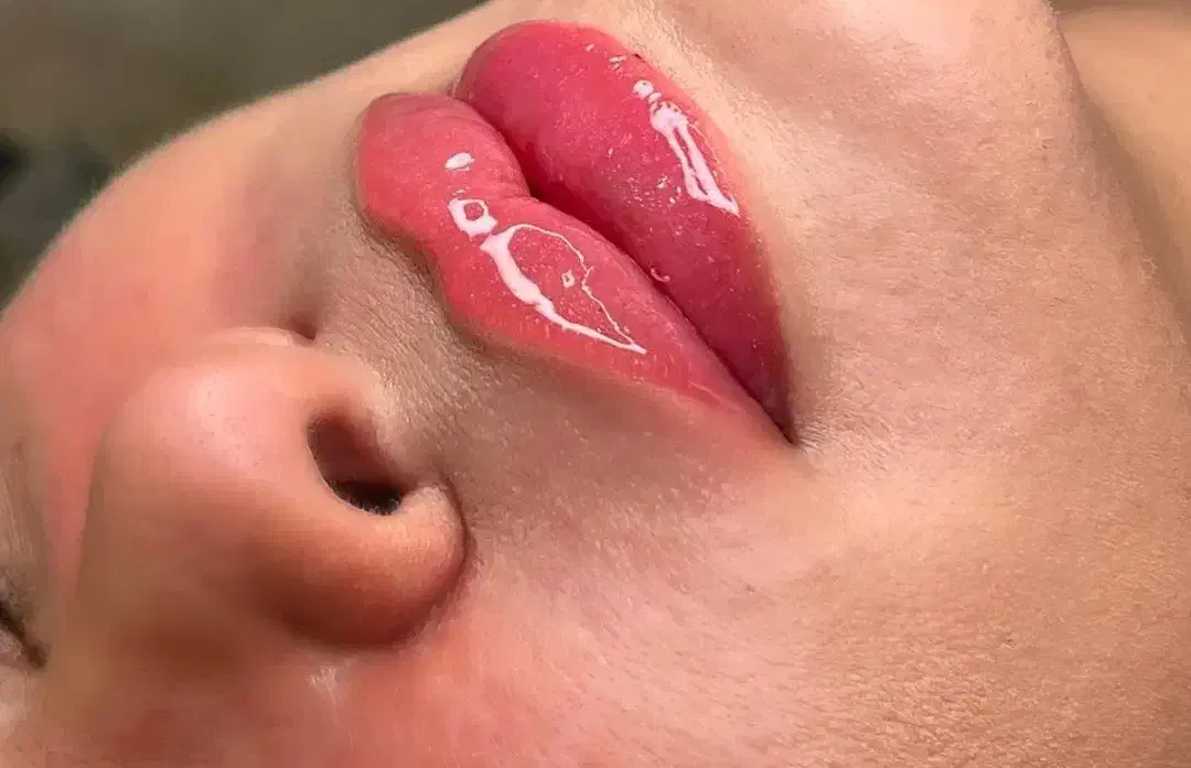 کلینیک تخصصی زیبایی/بوتاکس فیلر لاغری مزو PRP|خدمات آرایشگری و زیبایی|رفسنجان, |دیوار