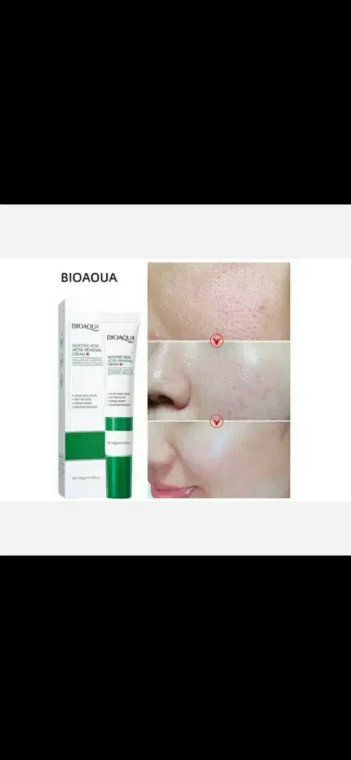 کرم زد جوش|آرایشی، بهداشتی، درمانی|بم, |دیوار