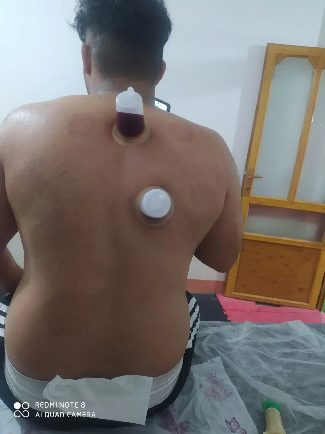 حجامت درمانی فیزیوتراپی وروغن و بادکش ورزشی|خدمات آرایشگری و زیبایی|اندیمشک, |دیوار