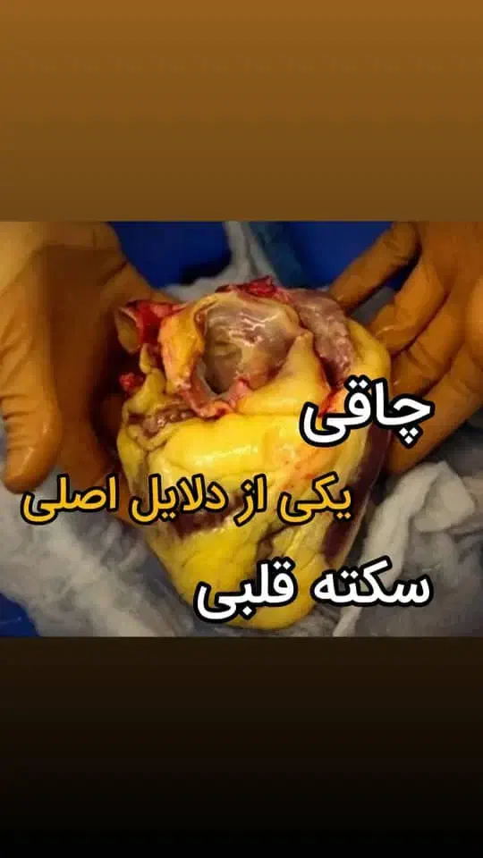 تخفیفات ویژه لیپوماتیک و ابدو و اسلیو اقساطی|خدمات آرایشگری و زیبایی|تهران, میدان ولیعصر|دیوار