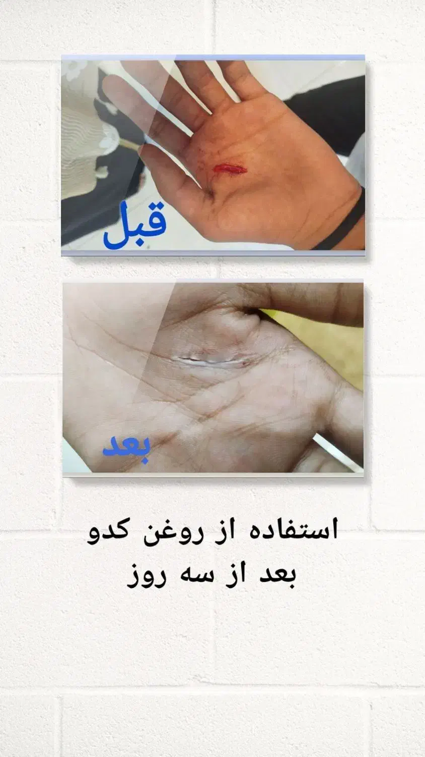 روغن خوراکی|خوردنی و آشامیدنی|برهسر, |دیوار