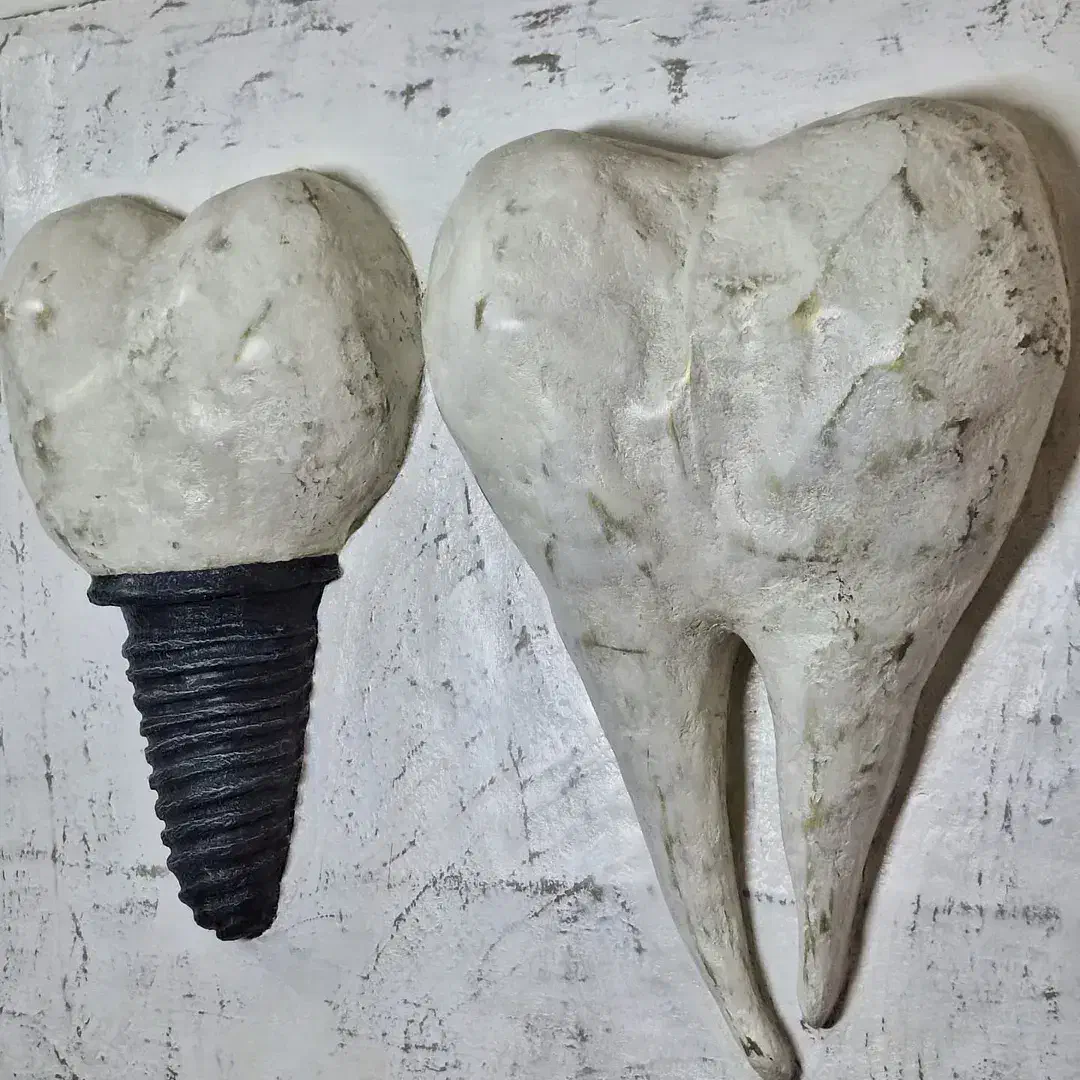 پاپیه ماشه دندان ایمپلنت|مجسمه، تندیس، ماکت|ارومیه, |دیوار