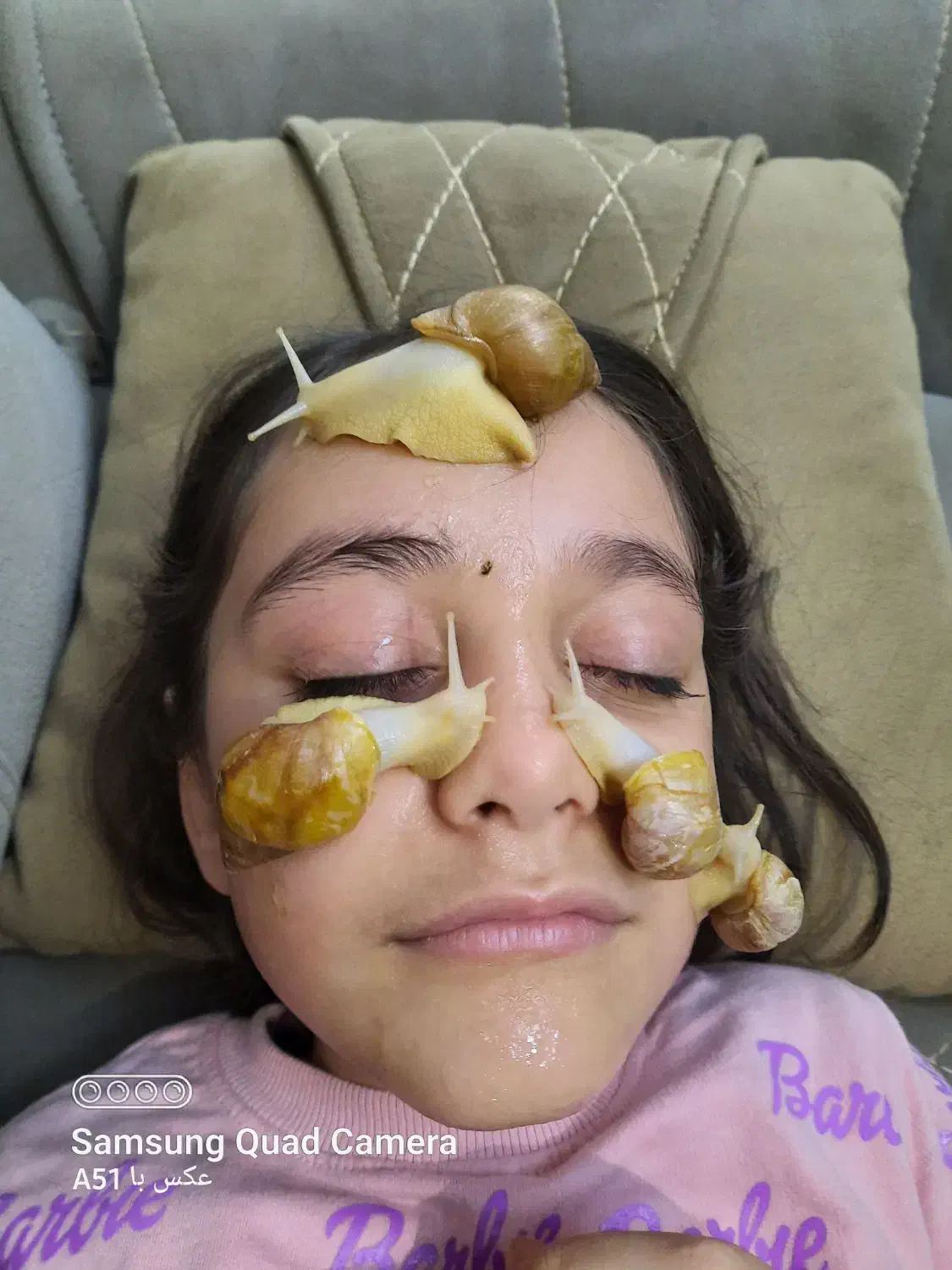 حلزون کلاژن ساز|آرایشی، بهداشتی، درمانی|مشکیندشت, |دیوار