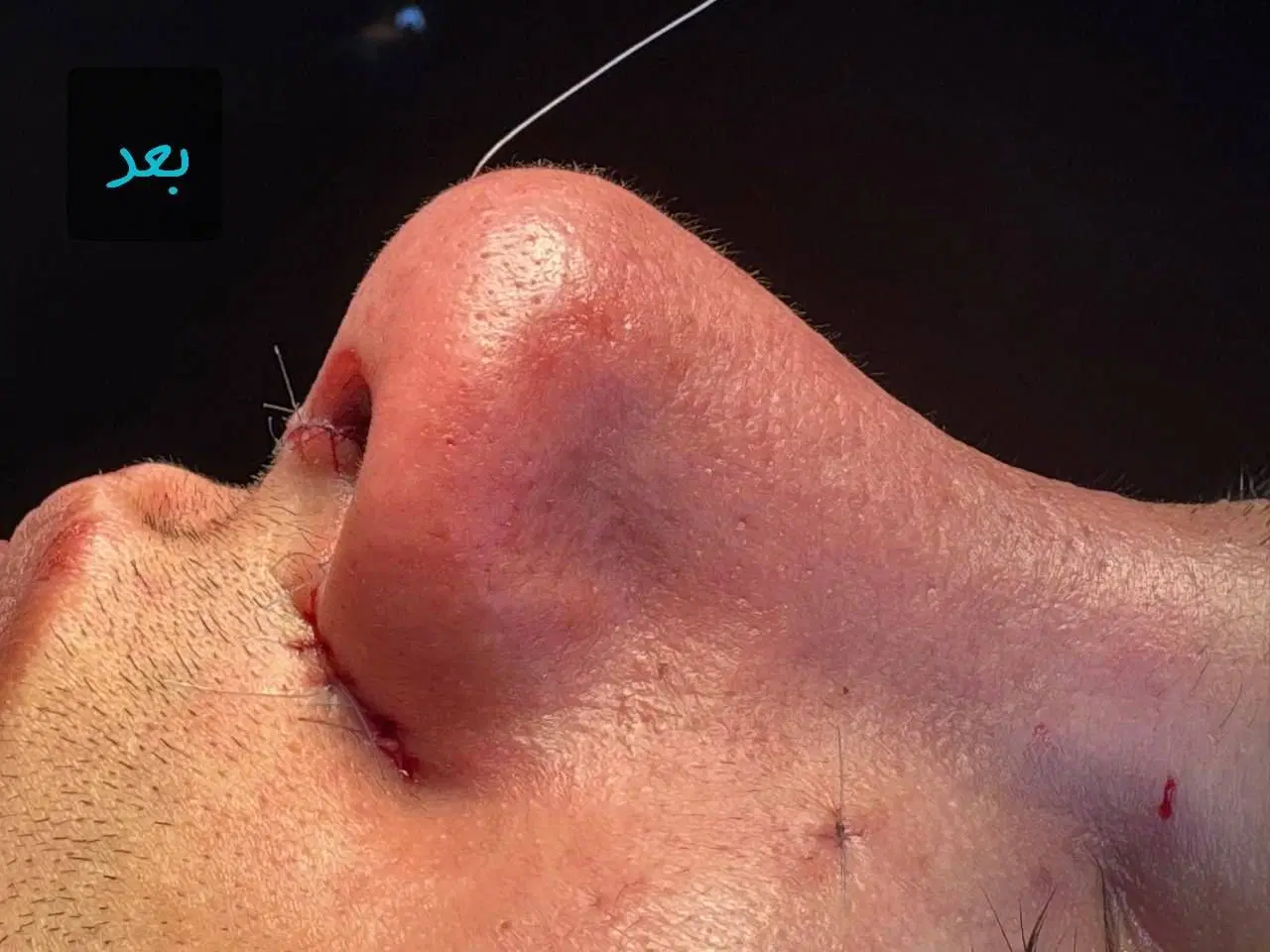 جراحی بینی ، پیکرتراشی ، لیفت صورت|خدمات زیبایی و سلامت|تهران, آسمان|دیوار