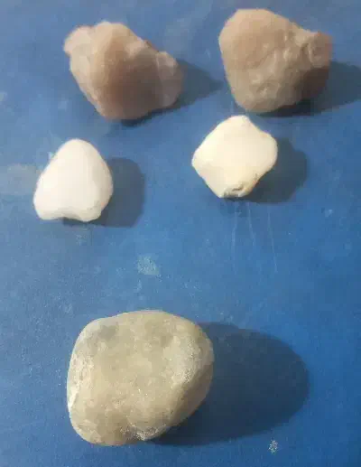 الماس ویاقوت ۱/۳۰۰و /۳۵۰بزرگترین ۲ و ۳۰۰ کیلوگرمی|جواهرات|شیراز, سفیرشمالی|دیوار