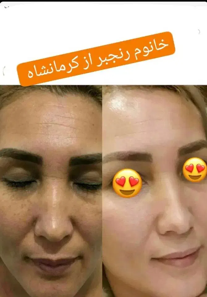 صابون لایه بردار گیاهی روشن کننده صورت وبدن|آرایشی، بهداشتی، درمانی|اهواز, آریاشهر|دیوار