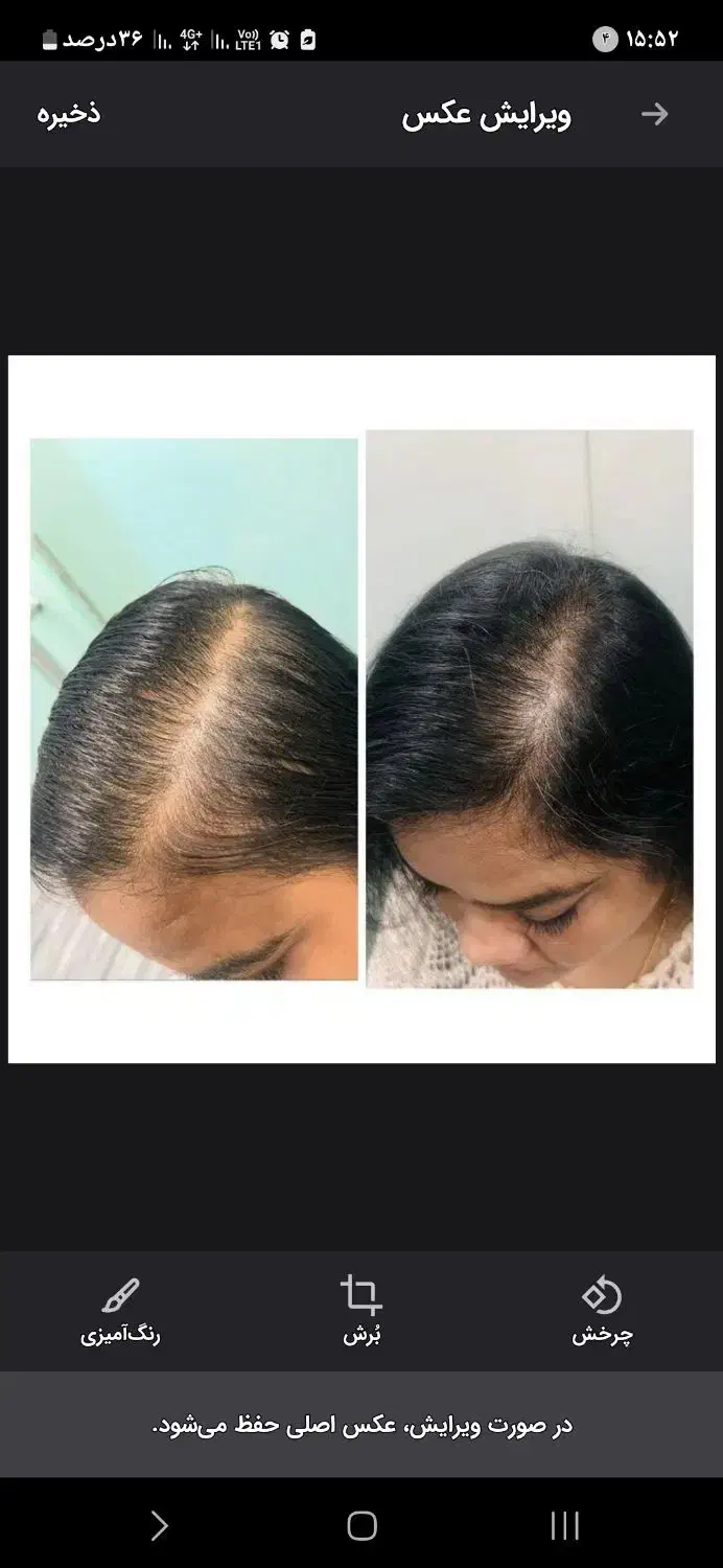 ریزش مو/رویش مجدد/رشد قدی مو /درمان کم پشتی مو|آرایشی، بهداشتی، درمانی|چاه داد خدا, |دیوار