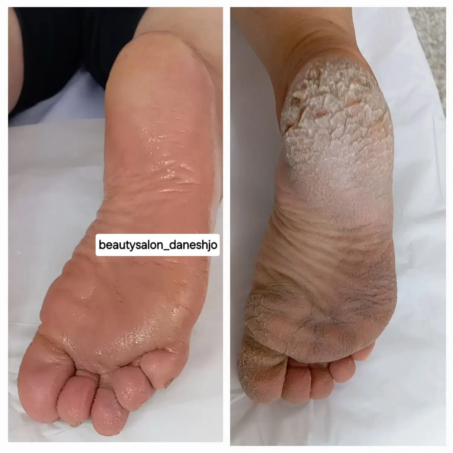 آموزش و خدمات کفسابی پا و کاشت ناخن اپیلاسیون|خدمات آرایشگری و زیبایی|ارومیه, |دیوار