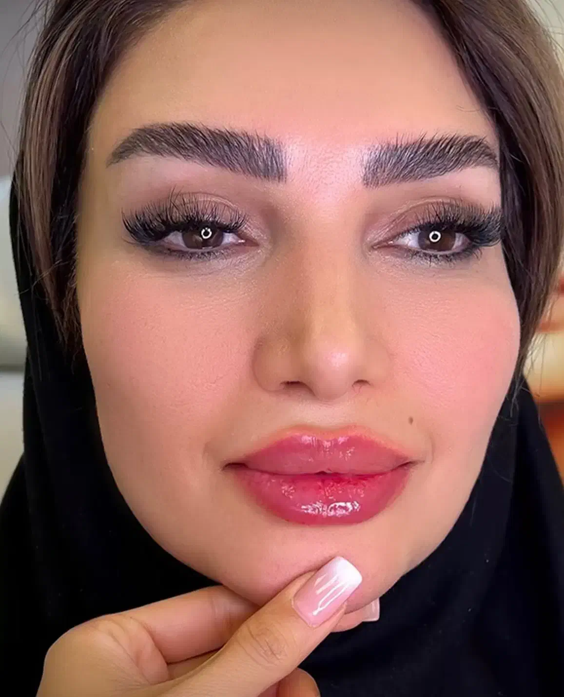 تزریق ژل لب بوتاکس مزو انزیم کانتورینگ لیفت صورت|خدمات آرایشگری و زیبایی|تهران, سعادت‌آباد|دیوار