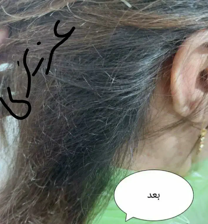 درمان صدرصدقطعی وتضمینی شپش ورشک|آرایشی، بهداشتی، درمانی|نورآباد, |دیوار