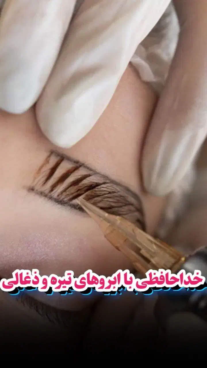 خداحافظی با تاتوهای زغالی و بدرنگ|خدمات آرایشگری و زیبایی|تهران, حکمت|دیوار