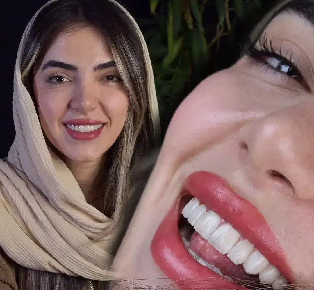 فستیوال اقساطی دندان پزشکی خدمات دندانپزشکی|خدمات آرایشگری و زیبایی|اصفهان, دشتستان|دیوار