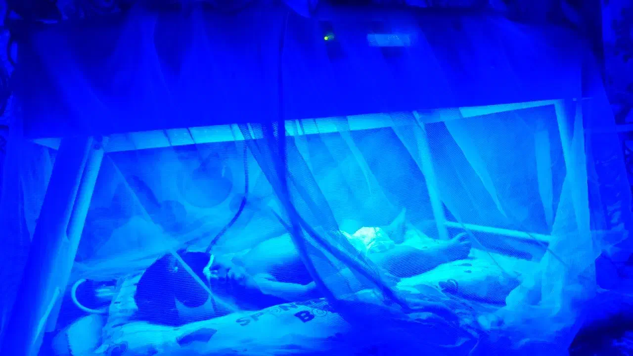 دستگاه نوزادان|آرایشی، بهداشتی، درمانی|زابل, |دیوار