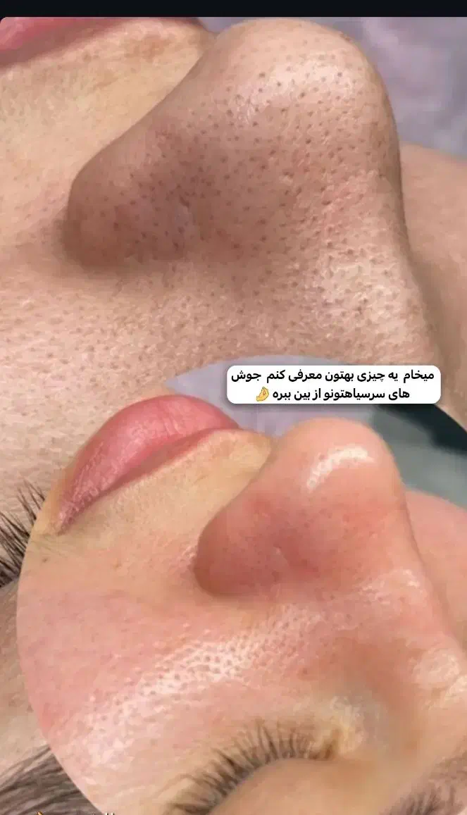 انجام یک خدمت زیبایی و دریافت یک خدمت هدیه|خدمات آرایشگری و زیبایی|چابهار, |دیوار