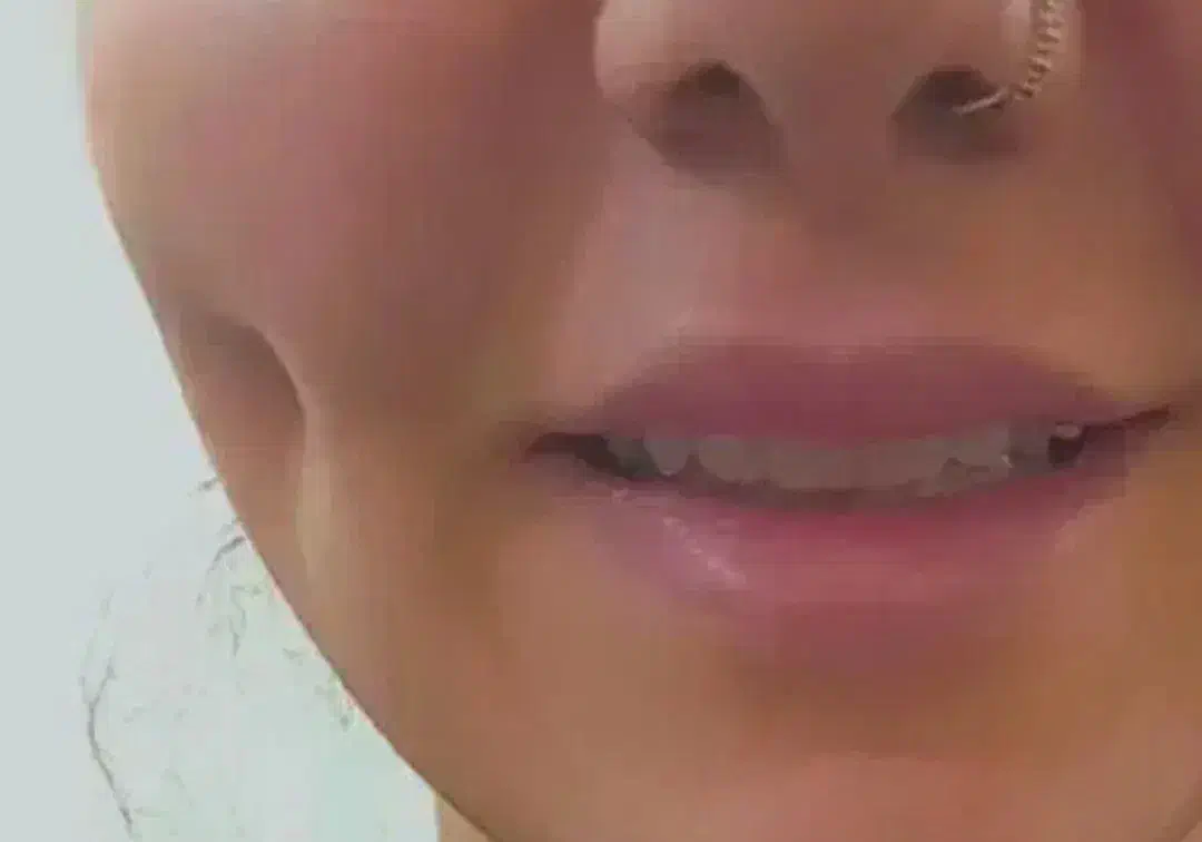 یلدایی چالگونه دائم با بخیه و انواع پیرسینگ|خدمات آرایشگری و زیبایی|گرگان, |دیوار