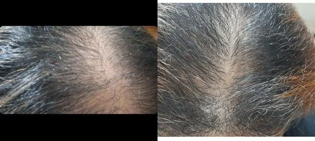 مو|آرایشی، بهداشتی، درمانی|تهران, فردوسی|دیوار