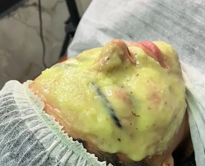 فشیال صورت و دست وپا|خدمات آرایشگری و زیبایی|شاهرود, |دیوار