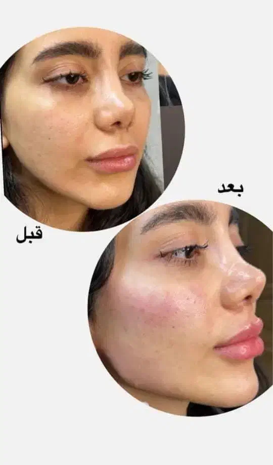 فیلر ژل لب بوتاکس تخصصی پزشک کلینیک تهرانسر|خدمات آرایشگری و زیبایی|اسلام‌شهر, باغ فیض|دیوار