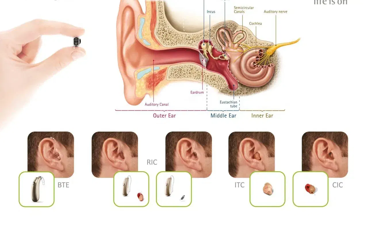 سمعک هوشمند2025|آرایشی، بهداشتی، درمانی|اسلام‌شهر, شهرک مفیدی|دیوار