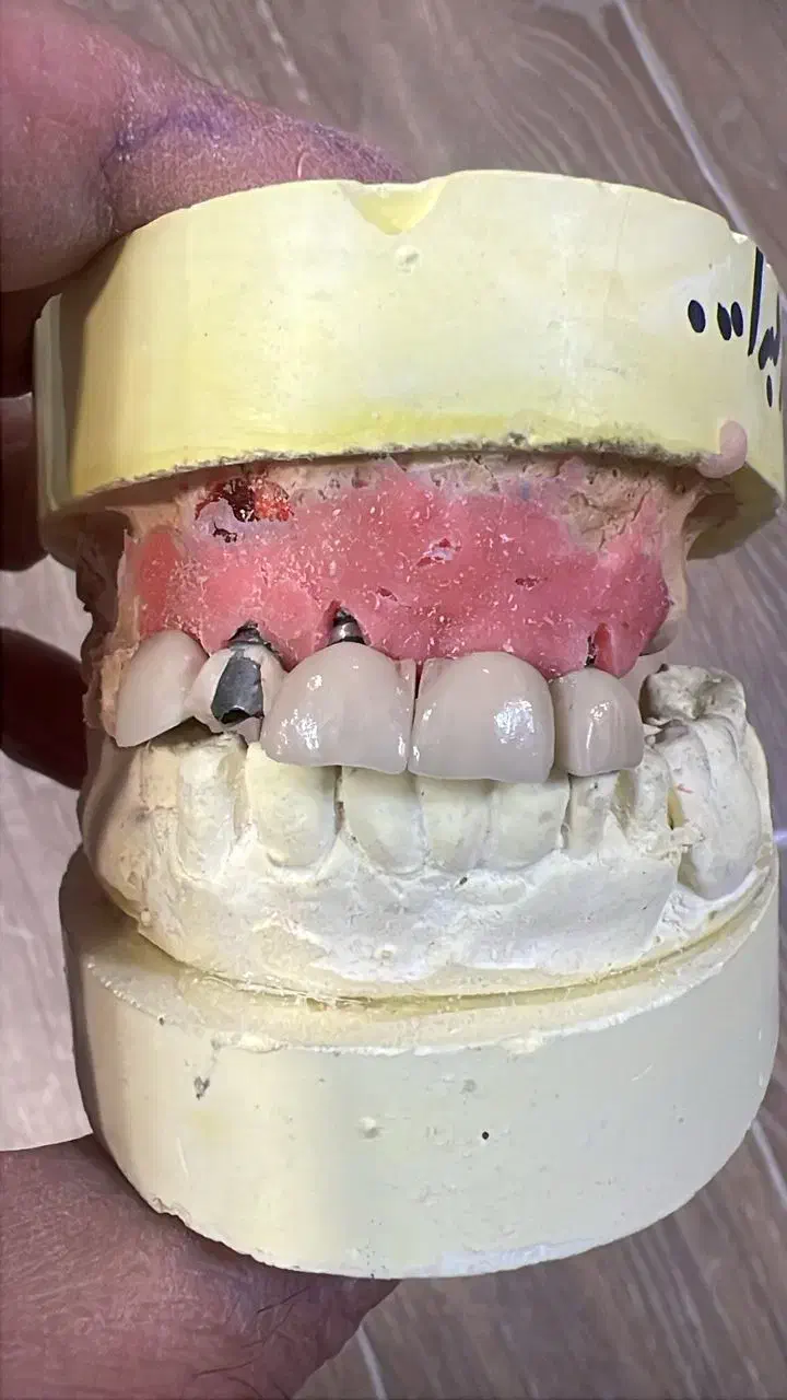 منشی و دستیار لابراتوار دندانسازی|استخدام درمانی، زیبایی، بهداشتی|تهران, جنت‌آباد جنوبی|دیوار