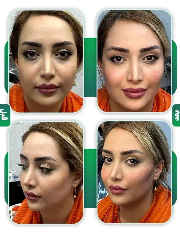 تزریق هرنوع خدمات زیبایی به صورت تضمینی|خدمات آرایشگری و زیبایی|کارون, |دیوار