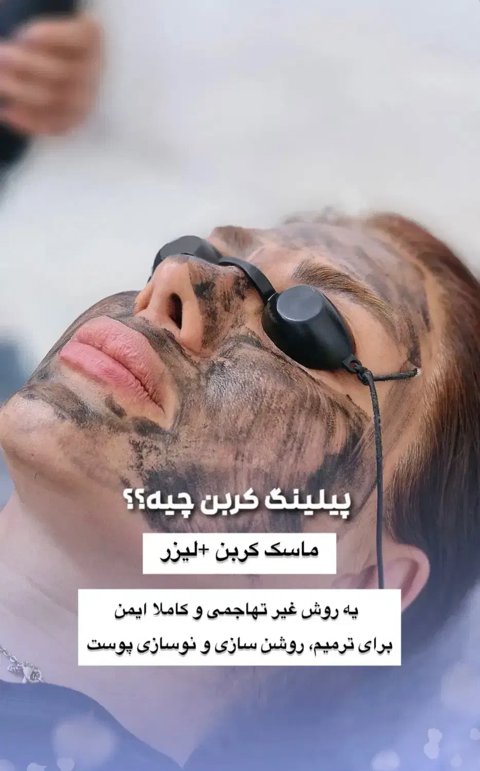 ریموو تتو مشکی و رنگی و لک|خدمات آرایشگری و زیبایی|شیراز, زرهی|دیوار