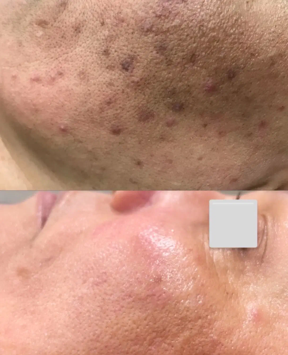 پاکسازی۱۴مرحله اقاوخانم کلینیک پزشک روشنی تضمینی|خدمات آرایشگری و زیبایی|بیرجند, |دیوار