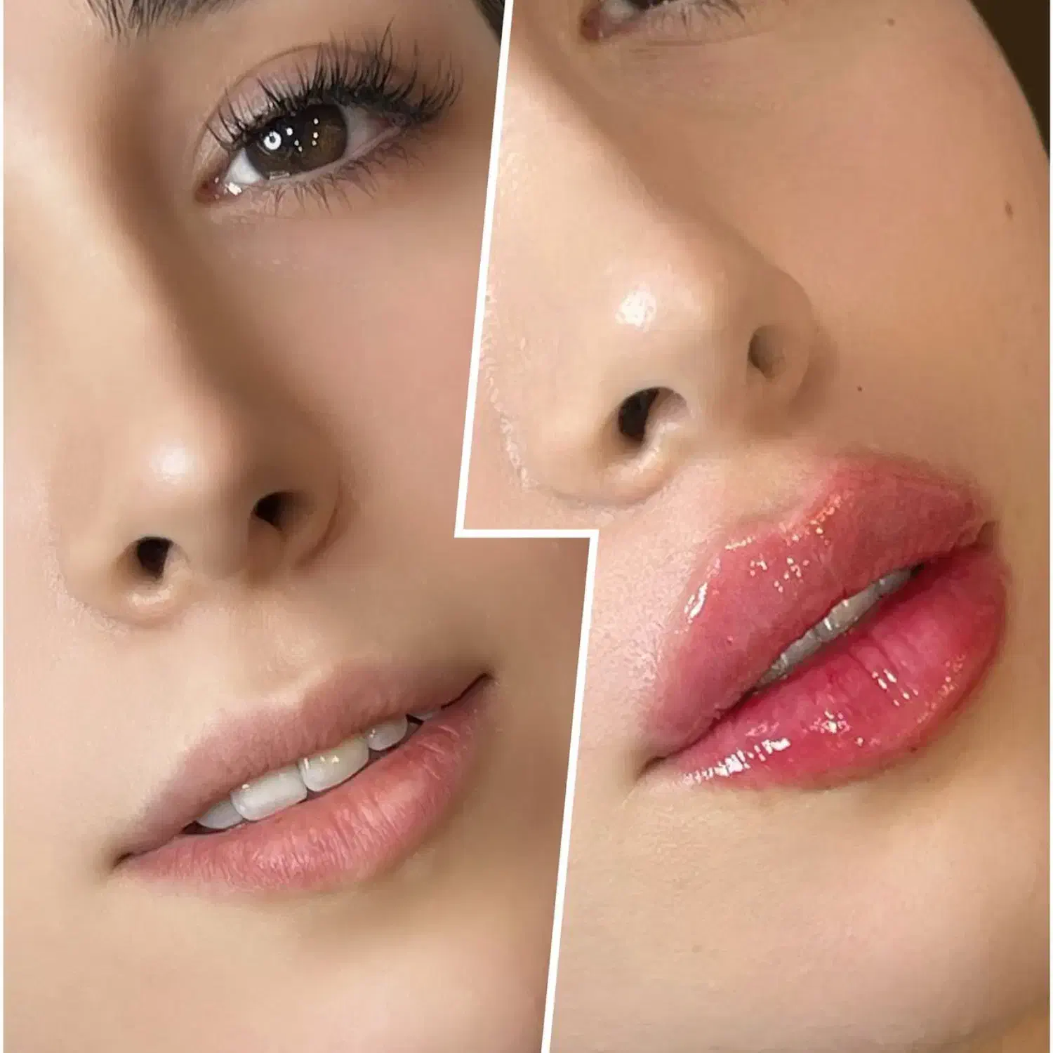 تزریق ژل،بوتاکس و (جشنواره یلدایی) کلینیک نوژین|خدمات آرایشگری و زیبایی|مشهد, سجاد شهر|دیوار