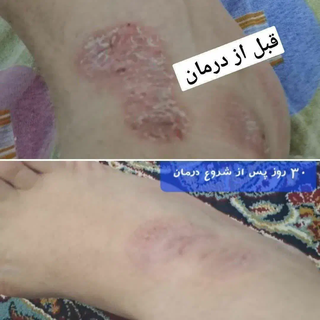 سلامت|فعالیت داوطلبانه|بجستان, |دیوار