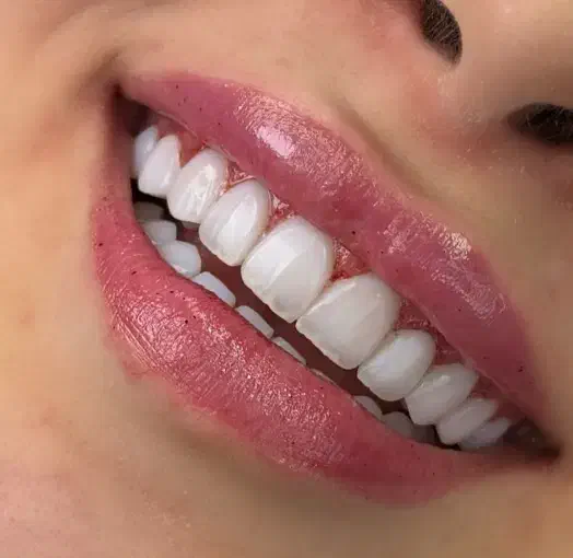 دندانپزشکی،ایمپلنت، اوردنچر|خدمات آرایشگری و زیبایی|مرند, |دیوار