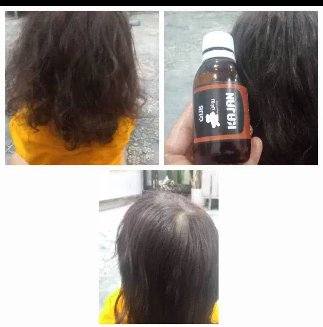 روغن های معجزه گر کاملا طبیعی و ارگانیک|خوردنی و آشامیدنی|ری, ملک‌آباد|دیوار