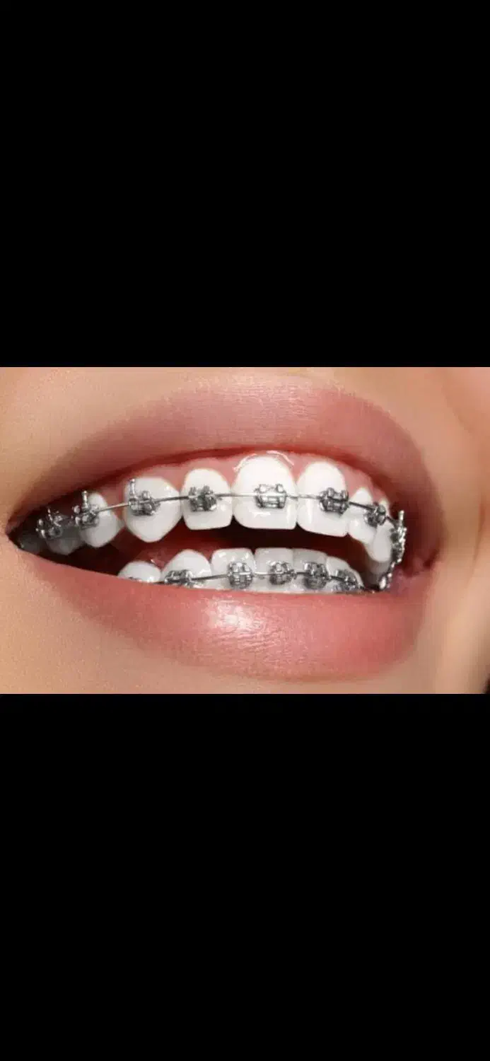 یک دستیار دندان پزشک محدوده ظفر|استخدام درمانی، زیبایی، بهداشتی|تهران, زرگنده|دیوار