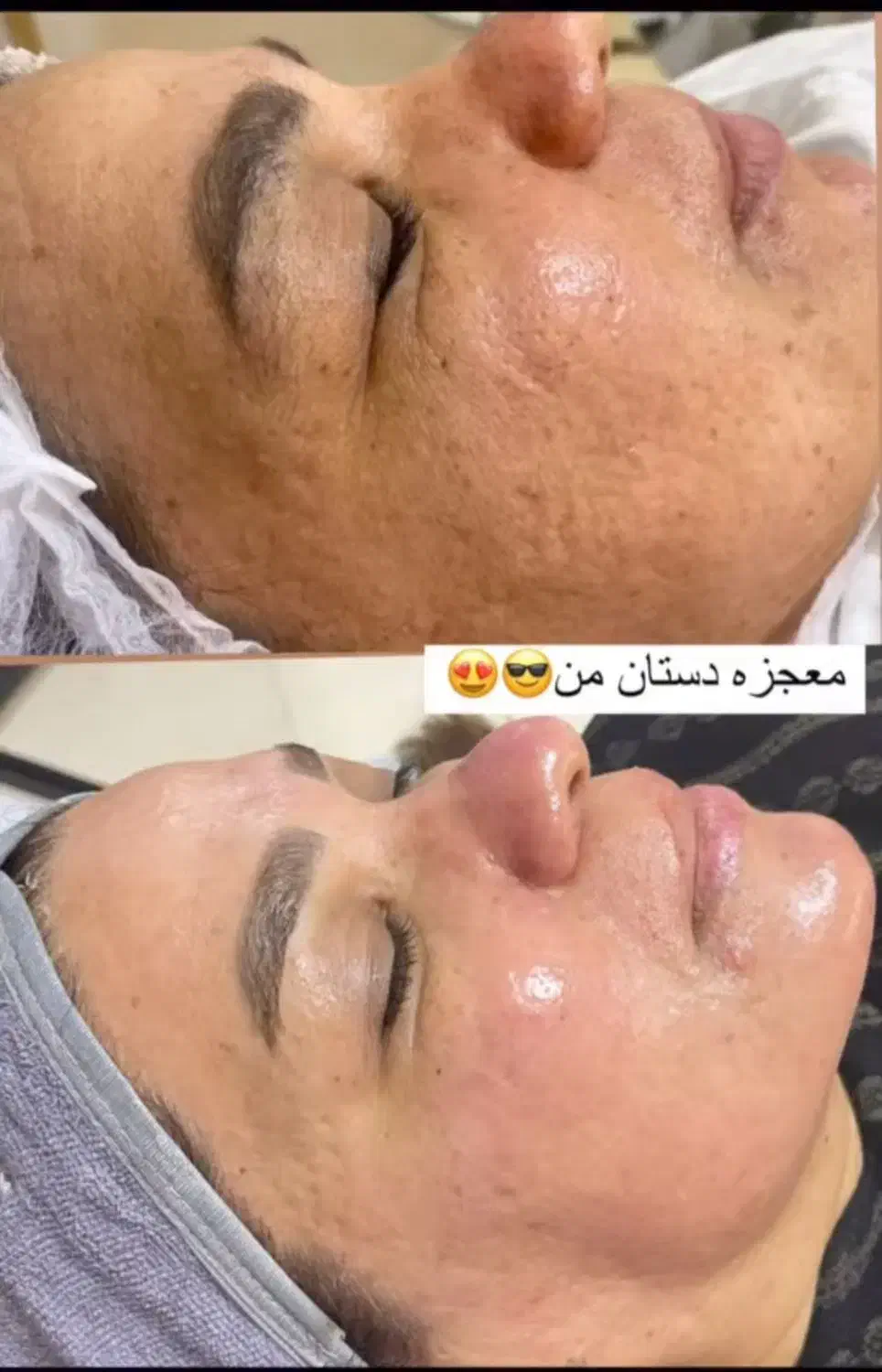 خدمات فیشیال ، پاکسازی ، جوانسازی پوست|خدمات آرایشگری و زیبایی|قم, شهرک قدس|دیوار
