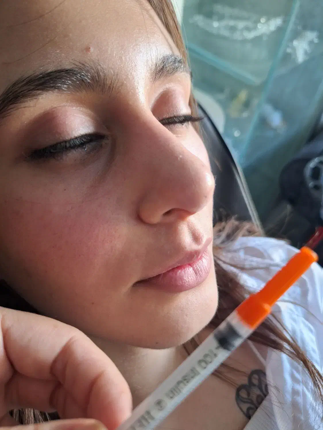 آنزیم بینی گوشتی غبغب پلاسما تراپی،مزونیدلینگ|خدمات آرایشگری و زیبایی|شیراز, محراب|دیوار