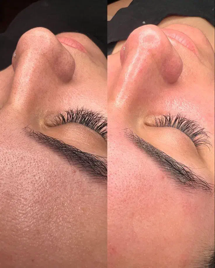 پاکسازی و جوانسازی صورت|خدمات آرایشگری و زیبایی|جم, |دیوار