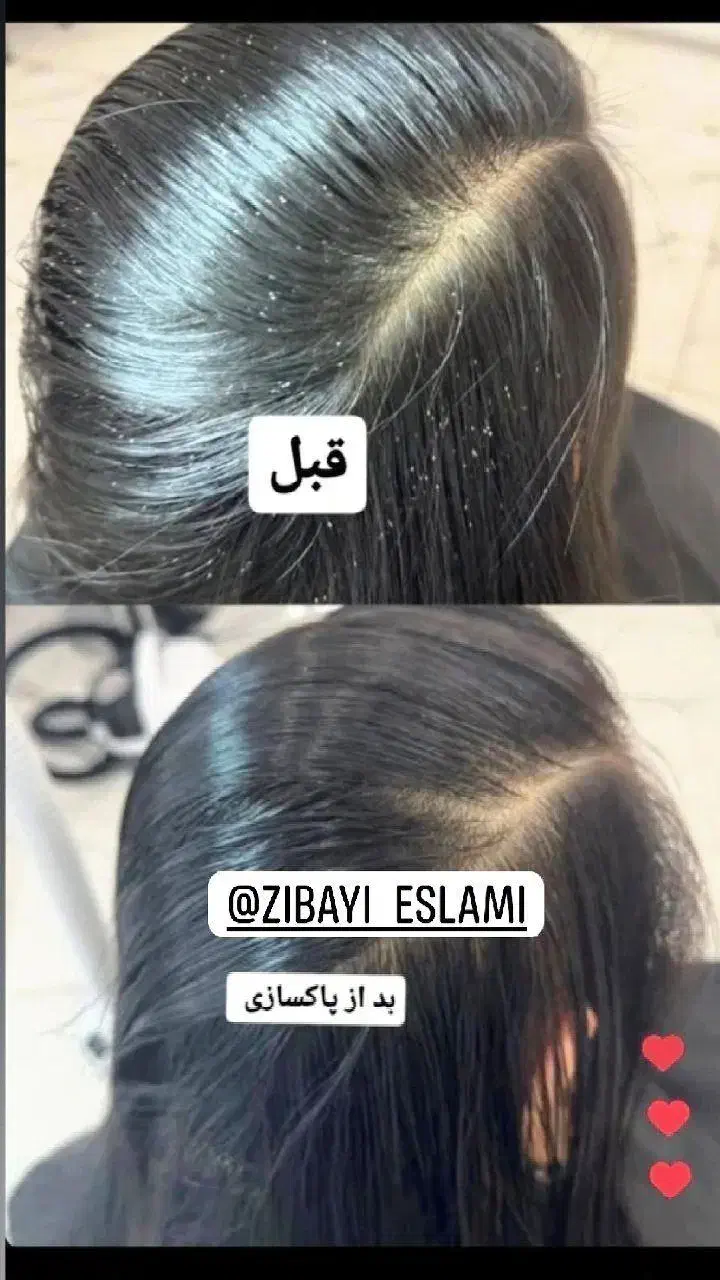 درمان تخصصی شپش|لوازم نظافت|تهران, سنائی|دیوار