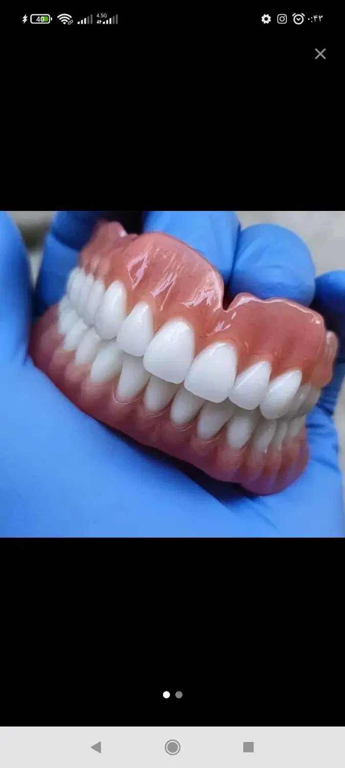 شرایط استثنایی ویژه ایمپلنت،اوردنچر،دندان مصنوعی|خدمات آرایشگری و زیبایی|تهران, مجیدیه|دیوار