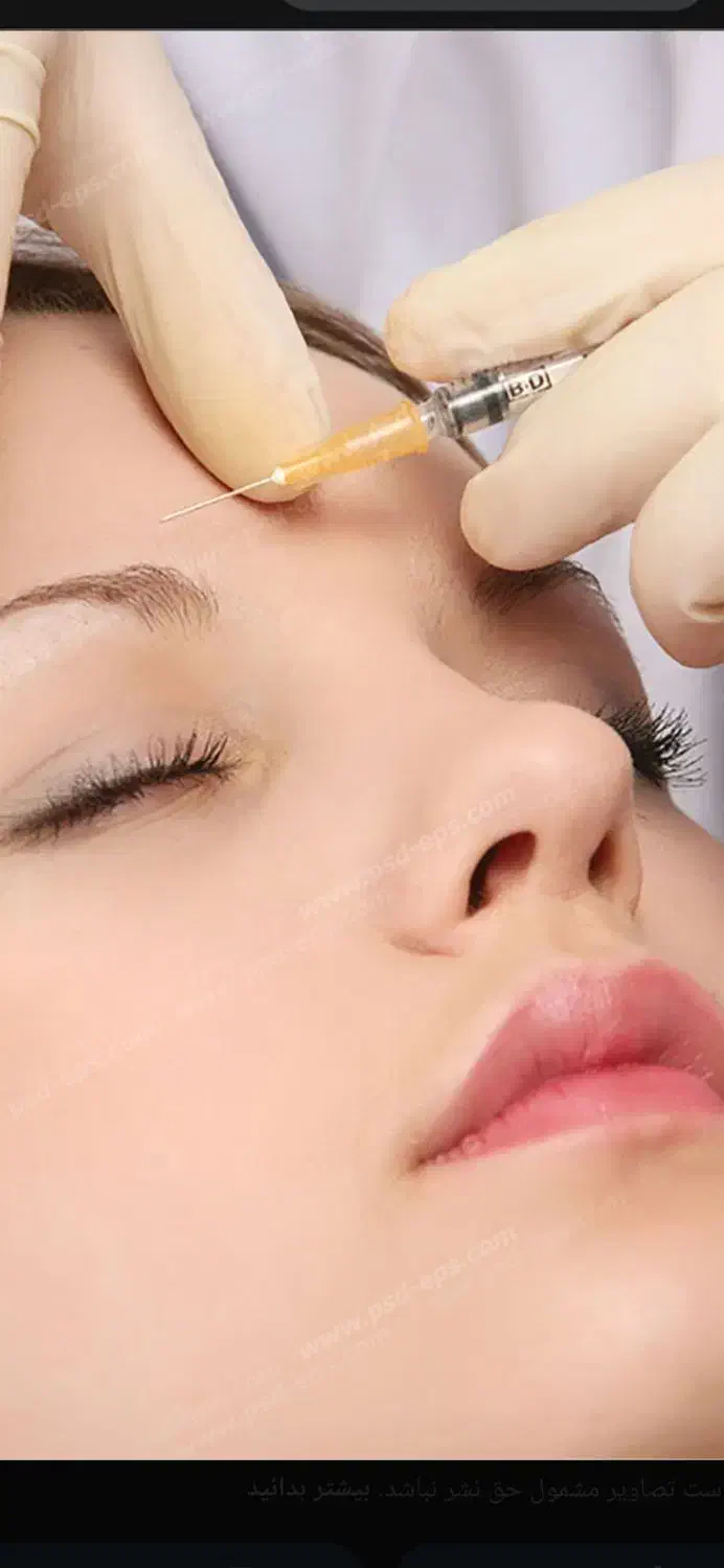 مدل برای تزریق بوتاکس و فیلر صورت|خدمات آرایشگری و زیبایی|دورود, |دیوار