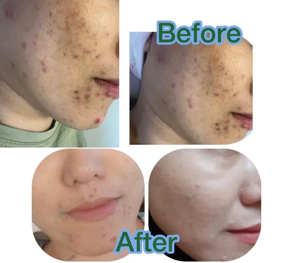 تخفیف ویژه یلدا و روز مادر فیشال تخصصی پوست|خدمات آرایشگری و زیبایی|مشهد, هفت تیر (آب و برق)|دیوار