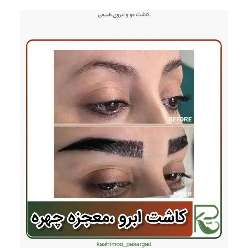 کاشت مو ابرو ریش تارکوب|خدمات آرایشگری و زیبایی|بیجار, |دیوار