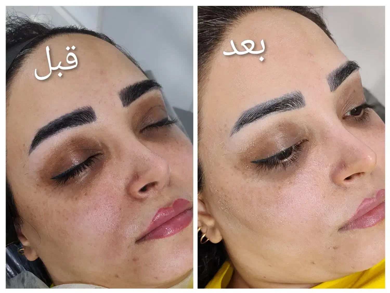 فیشیال تخصصی|خدمات آرایشگری و زیبایی|محمدشهر, محمدشهر|دیوار