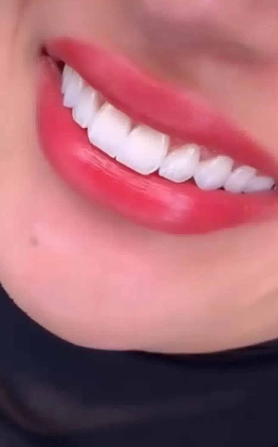 دندانساز|استخدام درمانی، زیبایی، بهداشتی|تهران, اختیاریه|دیوار