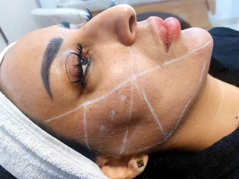 تزریق ژلوبوتاکس تخصصی در پرندبا نازلترین قیمت|خدمات آرایشگری و زیبایی|پرند, فاز ۲|دیوار